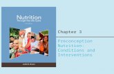 Chapter 3 Preconception Nutrition: Conditions and Interventions.