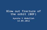 Blow out fracture of the orbit (BOF) Ayesha S Abdullah 14.09.2012.