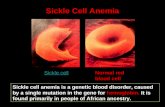 Hemoglobin. Sickle cell anemia is a genetic blood disorder, caused by a single mutation in the gene for hemoglobin. It is found primarily in people of.