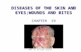 DISEASES OF THE SKIN AND EYES;WOUNDS AND BITES CHAPTER 19 Copyright © 2012 John Wiley & Sons, Inc. All rights reserved.