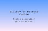 Biology of Disease CH0576 Peptic Ulceration Role of H. pylori.