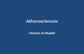 Atherosclerosis Hisham Al Khalidi. Vessel wall structure.