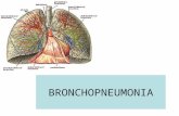 BRONCHOPNEUMONIA. Bronchopneumonia = acute inflammatory process in the area of respiratory bronchioli, alveolar structures and/or lung interstitium caused.
