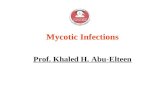 Mycotic Infections Prof. Khaled H. Abu-Elteen. Mycotic Infections ORGANISM: Genus/Species: There are a large number of different genera and species of.