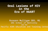 1 Oral Lesions of HIV in the Era of HAART Roseann Mulligan DDS, MS USC School of Dentistry and the Pacific AIDS Education and Training Center Roseann Mulligan.