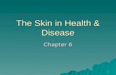 1 The Skin in Health & Disease Chapter 6. 2 The Integumentary System  Is formed by the skin and its APPENDAGES  Appendages include: –Hair –Nails –Glands.