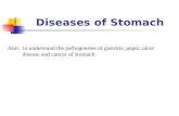 Diseases of Stomach Aim: to understand the pathogenesis of gastritis, peptic ulcer disease and cancer of stomach.