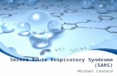 Severe Acute Respiratory Syndrome (SARS) Michael Leonard.