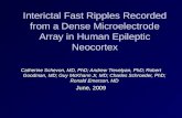 Interictal Fast Ripples Recorded from a Dense Microelectrode Array in Human Epileptic Neocortex Catherine Schevon, MD, PhD; Andrew Trevelyan, PhD; Robert.
