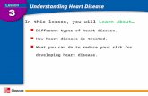Understanding Heart Disease In this lesson, you will Learn About… Different types of heart disease. How heart disease is treated. What you can do to reduce.
