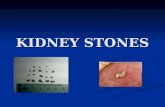 KIDNEY STONES. WHAT IS A KIDNEY STONE?? Solid piece of material that forms in kidney out of substances in the urine. Solid piece of material that forms.