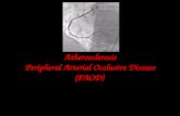 Atherosclerosis Peripheral Arterial Occlusive Disease (PAOD)