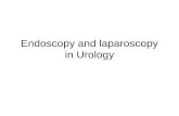 Endoscopy and laparoscopy in Urology. Endoscopy-„look inside” Optical- internal examination of organs In Urology means: Cystoscopy Urethroscopy Ureteroscopy.