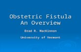 Obstetric Fistula An Overview Brad R. MacKinnon University of Vermont.