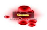 Anemia Amongst today’s children. Types of Anemia Hemolytic anemia: In this case, red blood cells get destroyed before they are suppose to be. Infections.