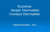 Eczema Atopic Dermatitis Contact Dermatitis Fahad Al Sudairy, M.D.