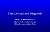 Skin Lesions and Diagnosis James H Herndon MD Clinical Professor, Dermatology UT Southwestern Medical Center.