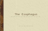 The Esophagus. Historical Aspects The earliest esophageal procedures were limited to the cervical region (removal of foreign bodies-1863) Modified ureteroscope.
