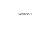 Scoliosis. ...... is defined as an appreciable lateral deviation in the normally straight vertical line of the spine. -Panjabi & White.