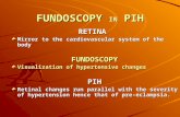 FUNDOSCOPY IN PIH RETINA Mirror to the cardiovascular system of the body FUNDOSCOPY Visualization of hypertensive changes PIH Retinal changes run parallel.