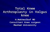 Total Knee Arthroplasty in Valgus knee H.Makhmalbaf MD Consultant Knee surgeon Mashad University.