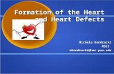 Formation of the Heart and Heart Defects Michele Kondracki MSIImkondracki@hmc.psu.edu.