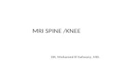 MRI SPINE /KNEE DR, Mohamed El Safwany, MD.. Intended learning outcome The student should learn at the end of this lecture MRI aspects of spine and knee.