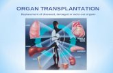 ORGAN TRANSPLANTATION Replacement of diseased, demaged or worn-out organs.