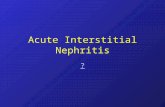 Acute Interstitial Nephritis ?. Etiology A review of three series with a total of 128 patients reported the following distribution of causes of acute.