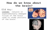 How do we know about the brain? Lesion: natural or experimentally damaged tissue of the brain used to study portions of the brain. Old Way:
