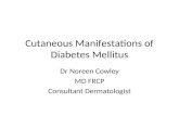 Cutaneous Manifestations of Diabetes Mellitus Dr Noreen Cowley MD FRCP Consultant Dermatologist.