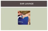 EAR LAVAGE. Purpose: To clean the external ear of cerumen or a foreign body. EAR IRRIGATION PROCEDURE.