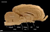 TelDiMesMetMyel Corpus callosum Fornix Interthalamic adhesion Tectum Tegmentum Cerebellum Pons Medulla Hypothalamus FORE MID HIND Horse brain 2012 Martin.