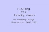 FISHing for tricky naevi Dr Hardeep Singh Manchester BAOP 2011.