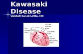 Kawasaki Disease Vaishali Soneji Lafita, MD. Presentation – Patient 1 10 years old male with Kawasaki Disease 10 years old male with Kawasaki Disease.