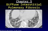 © 2007 McGraw-Hill Higher Education. All rights reserved. Chapter 5 Diffuse Interstitial Pulmonary Fibrosis.