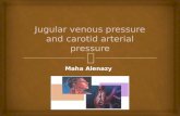 Maha Alenazy.   What are Jugular venous pressure and Carotid arterial pressure  their normal recording  Abnormalities and clinical importance  Difference.