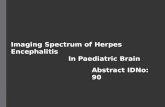 Imaging Spectrum of Herpes Encephalitis In Paediatric Brain Abstract IDNo: 90.
