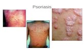 Psoriasis. Atopic Dermatitis Contact Dermatitis