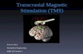 Transcranial Magnetic Stimulation (TMS) Peter P. Ricci Biomedical Engineering BME 281 Section 1.