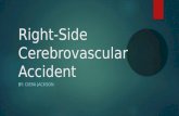 Right-Side Cerebrovascular Accident BY: CIERA JACKSON.