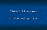 Global Blindness Nicholas Seeliger, M.D.. Global Blindness Distribution of Blindness Distribution of Blindness Cataract Cataract Vitamin A Deficiency.