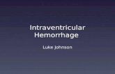 Intraventricular Hemorrhage Luke Johnson. Overview IVH Most common brain implication in premature babies Bleeding into the ventricles Underdeveloped.