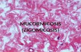 Rhizopus Mucor Cunninghamella Apophysomyces Absidia Saksenae E.U.A 500 casos al año E.U.A 500 casos al año D. Schlossberg, “Clinical Infectious Disease”,