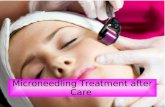 Microneedling Treatment after Care