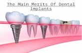 The Main Merits Of Dental Implants
