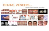 Dental Veneers Gives You Reason To Smile