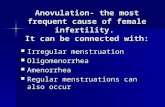 Anovulation- the most frequent cause of female infertility.  It can be connected with: