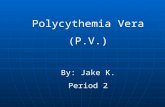 Polycythemia Vera (P.V.) By: Jake K. Period 2