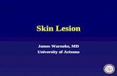 Skin Lesion